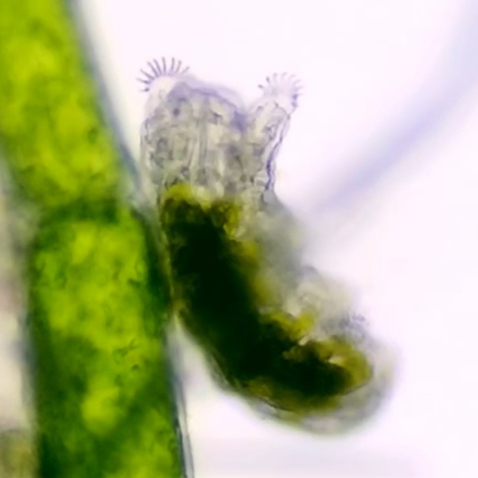 Echiniscoides sigismundi