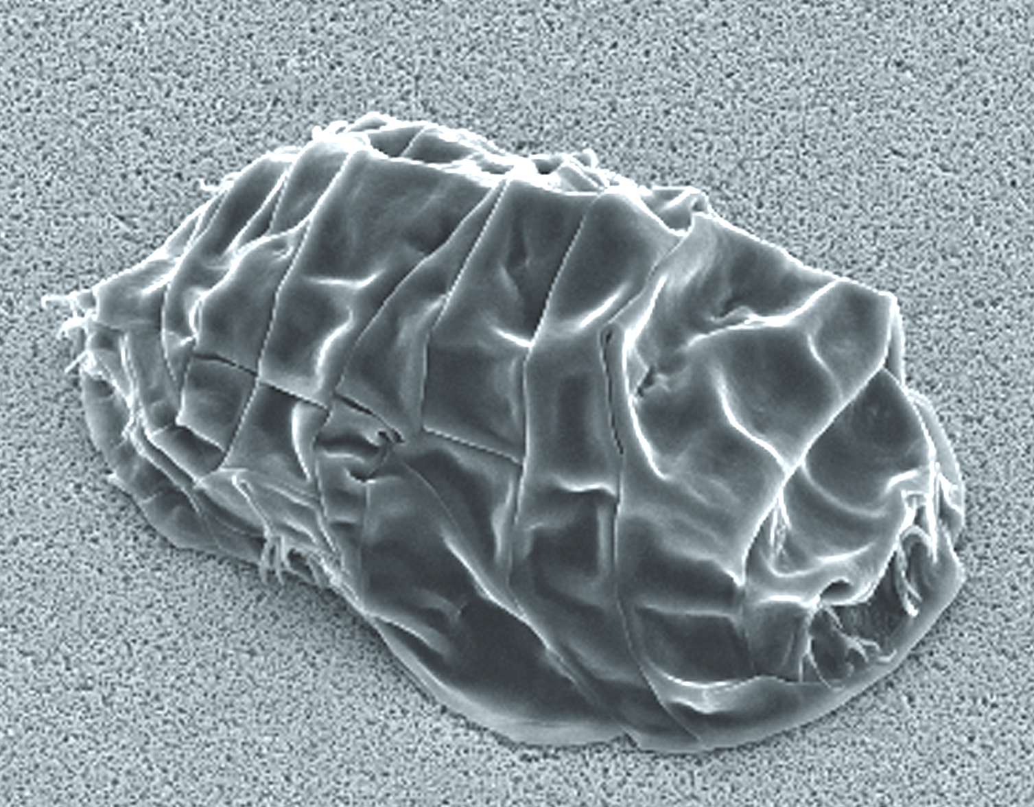Milnesium tun SEM