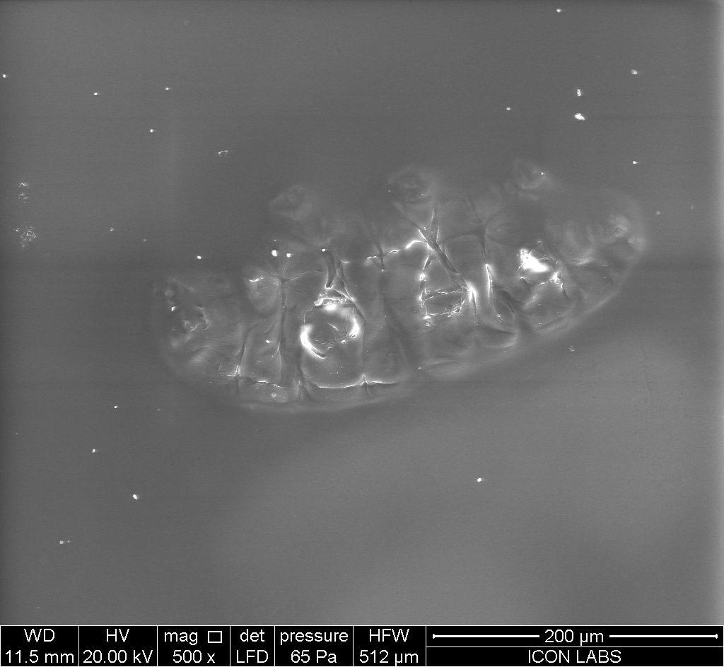 SEM ventral view of an unidentified tardigrade